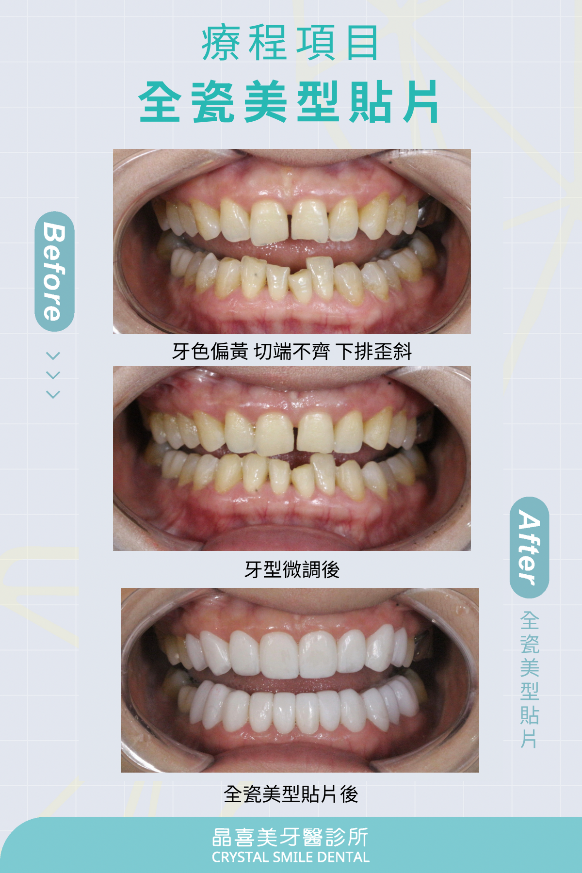 有效率的微調