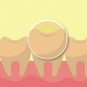 牙齒黃 黃板牙 牙齒美白 美白貼片