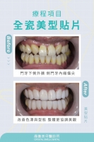 徹底改變牙齒形態