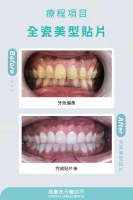 改變牙色