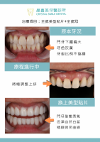 一點點的微調,帶來很大的改變