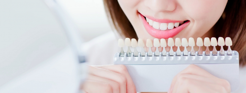 牙齒美白貼片