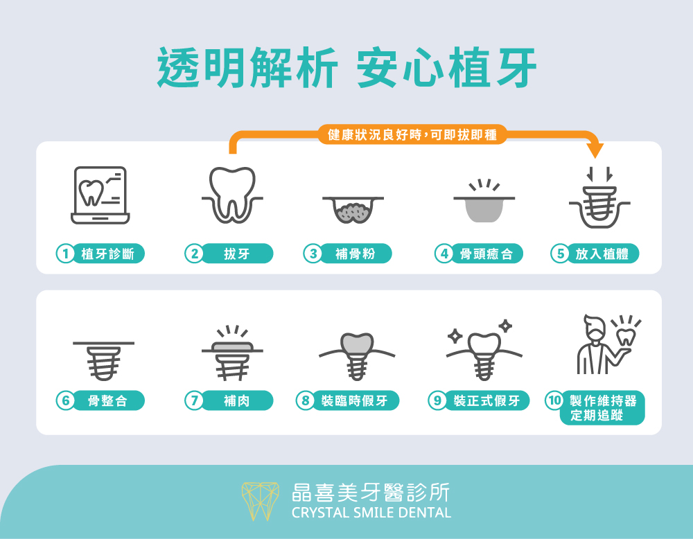 晶喜美牙醫診所安心植牙流程