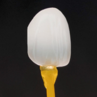 全瓷美型貼片-陶瓷貼片-美白貼片