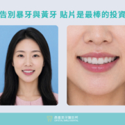 晶喜美牙醫診所 暴牙黃牙案例